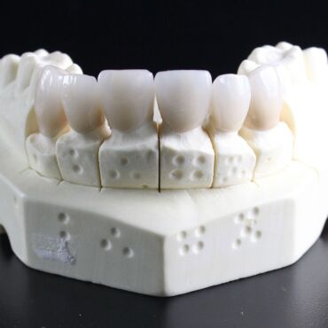 The Importance of Aesthetics and Function in Prosthetic Dentistry